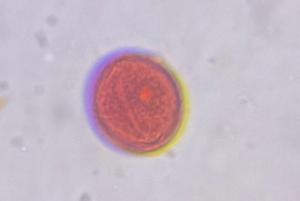 Mesquite pollen under a microscope, verified by PollyMap