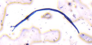 Fiber fiber under a microscope, verified by PollyMap