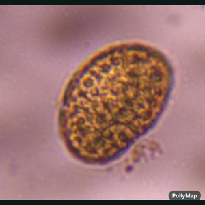 fern spore pollen under a microscope, verified by PollyMap