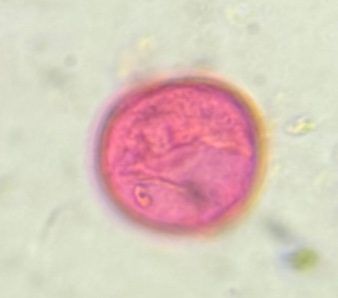 Another microscope image of Poaceae, verified by PollyMap