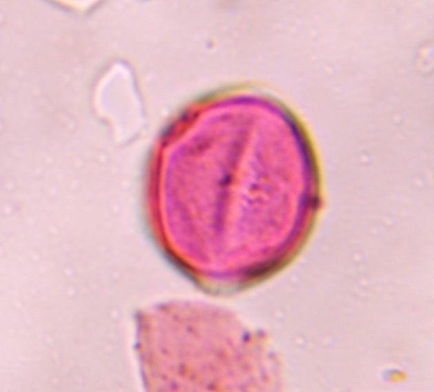 Artemisia pollen under a microscope, verified by PollyMap