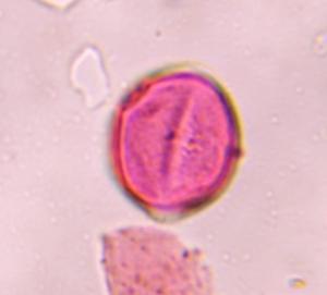 Artemisia pollen under a microscope, verified by PollyMap