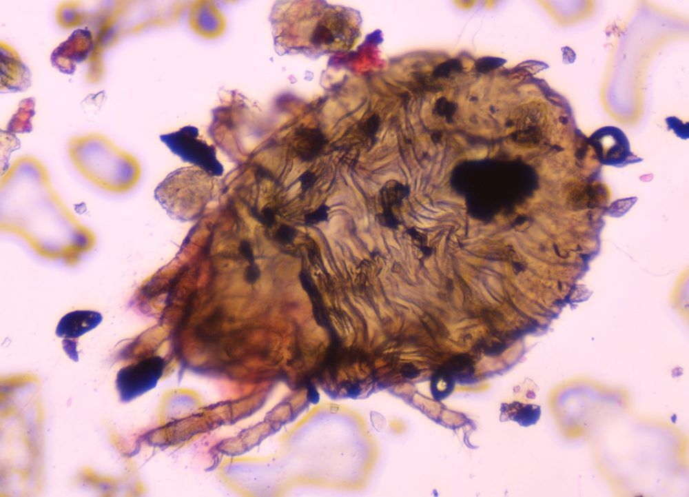 Microscope image of Dust mite, verified by PollyMap