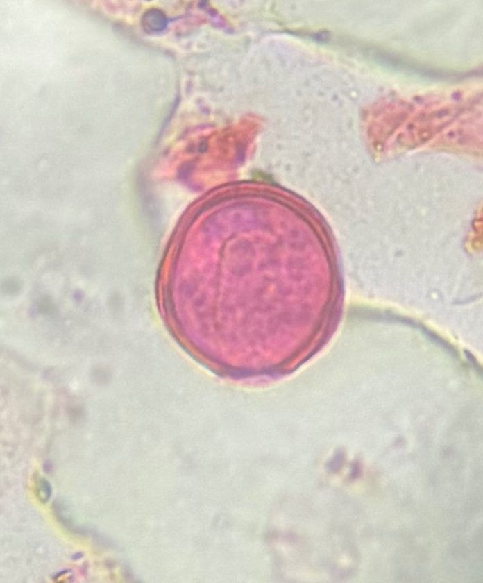 Nettle pollen under a microscope, verified by PollyMap