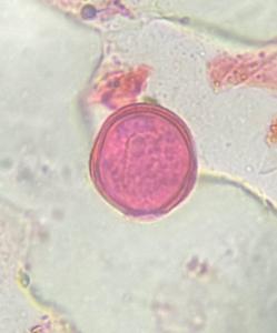 Nettle pollen under a microscope, verified by PollyMap