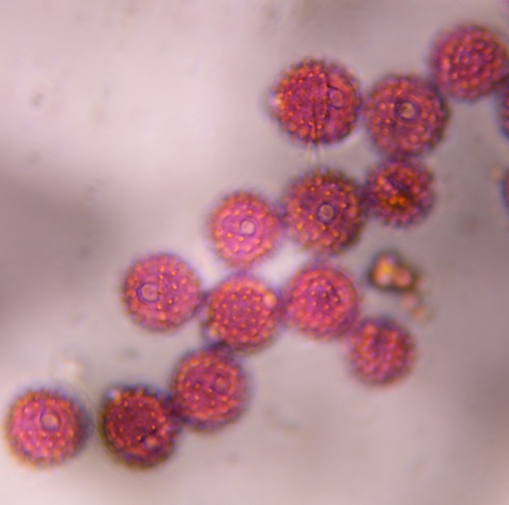 Asteraceae pollen under a microscope, verified by PollyMap