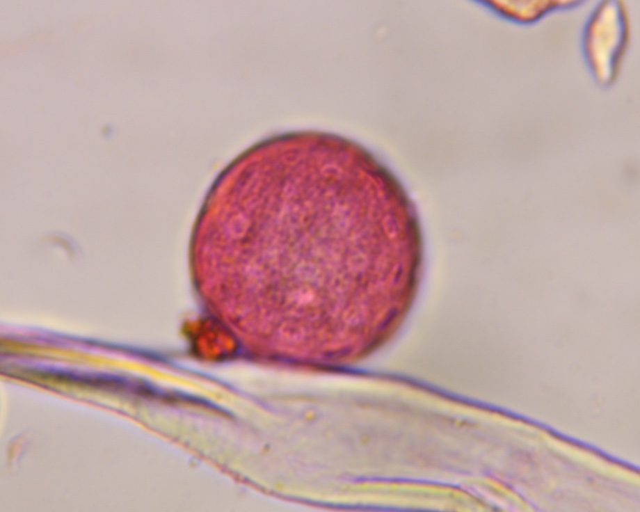 Another microscope image of Chenopod, verified by PollyMap
