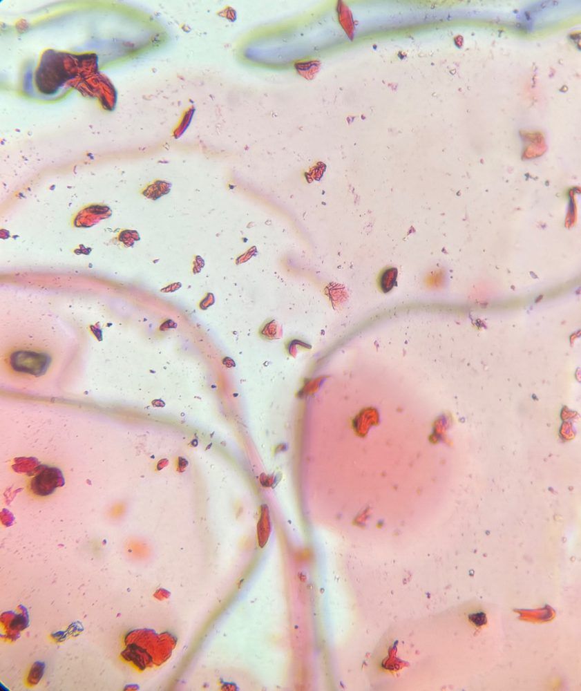 Microscope image of Skin cells, verified by PollyMap