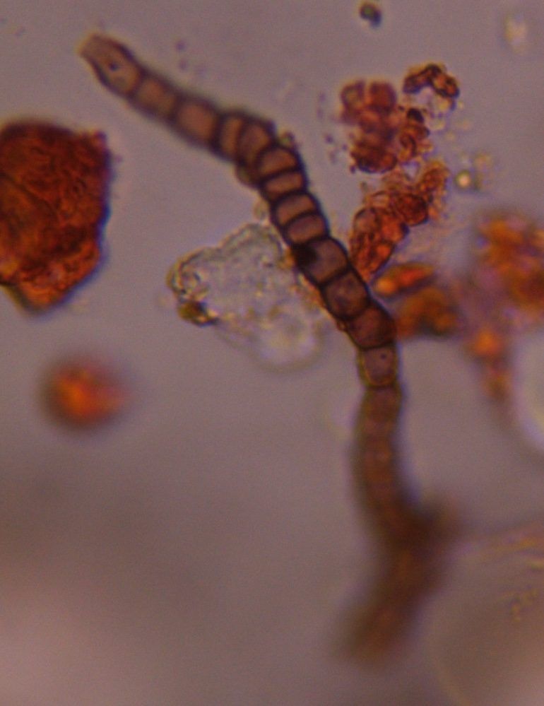 Helminthosporium mold spore under a microscope, verified by PollyMap