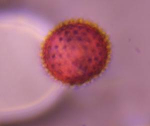 Asteraceae pollen under a microscope, verified by PollyMap