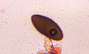 Dematiaceous ascospore mold spore under a microscope, verified by PollyMap