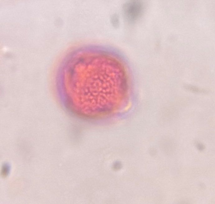 Another microscope image of Artemisia, verified by PollyMap