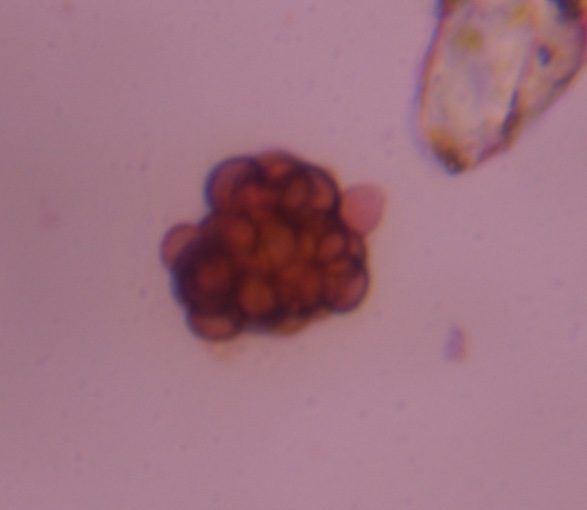 Epicoccum mold spore under a microscope, verified by PollyMap