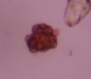 Epicoccum mold spore under a microscope, verified by PollyMap