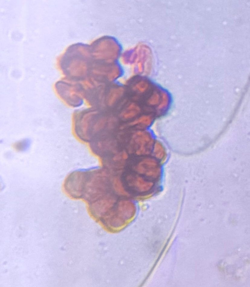 Epicoccum mold spore under a microscope, verified by PollyMap
