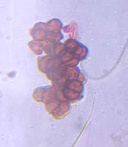 Epicoccum mold spore under a microscope, verified by PollyMap