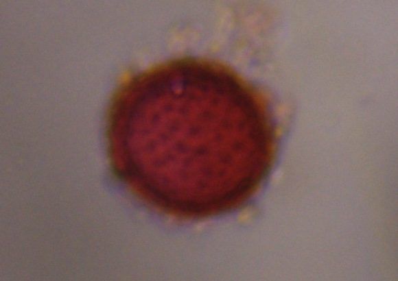 Asteraceae pollen under a microscope, verified by PollyMap