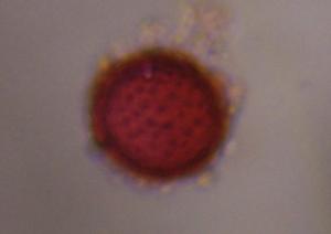Asteraceae pollen under a microscope, verified by PollyMap