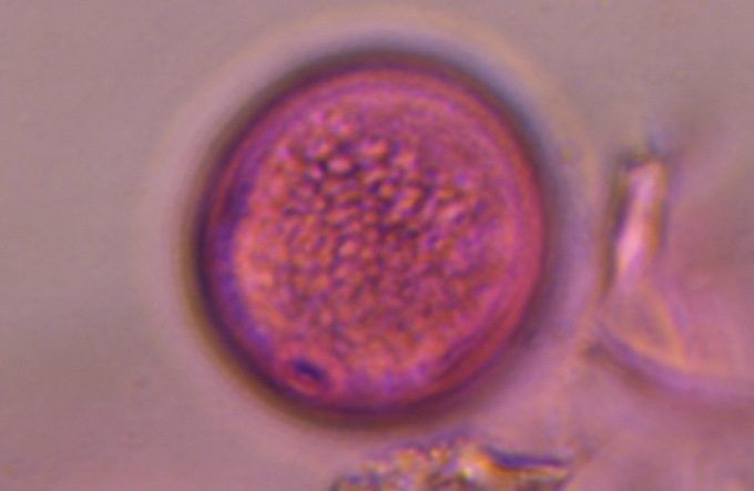 Another microscope image of Poaceae, verified by PollyMap