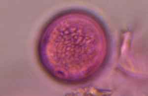 Poaceae pollen under a microscope, verified by PollyMap
