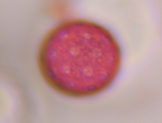 Chenopod pollen under a microscope, verified by PollyMap