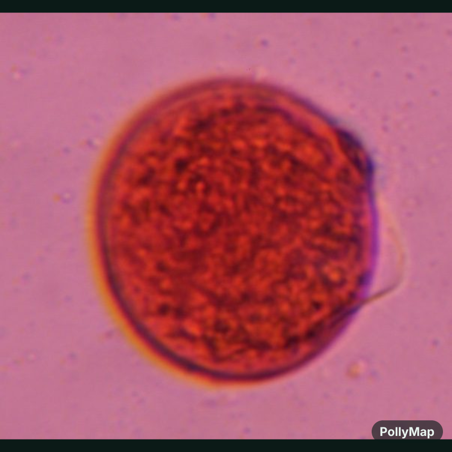 Another microscope image of Poaceae, verified by PollyMap