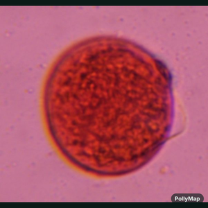 Poaceae pollen under a microscope, verified by PollyMap