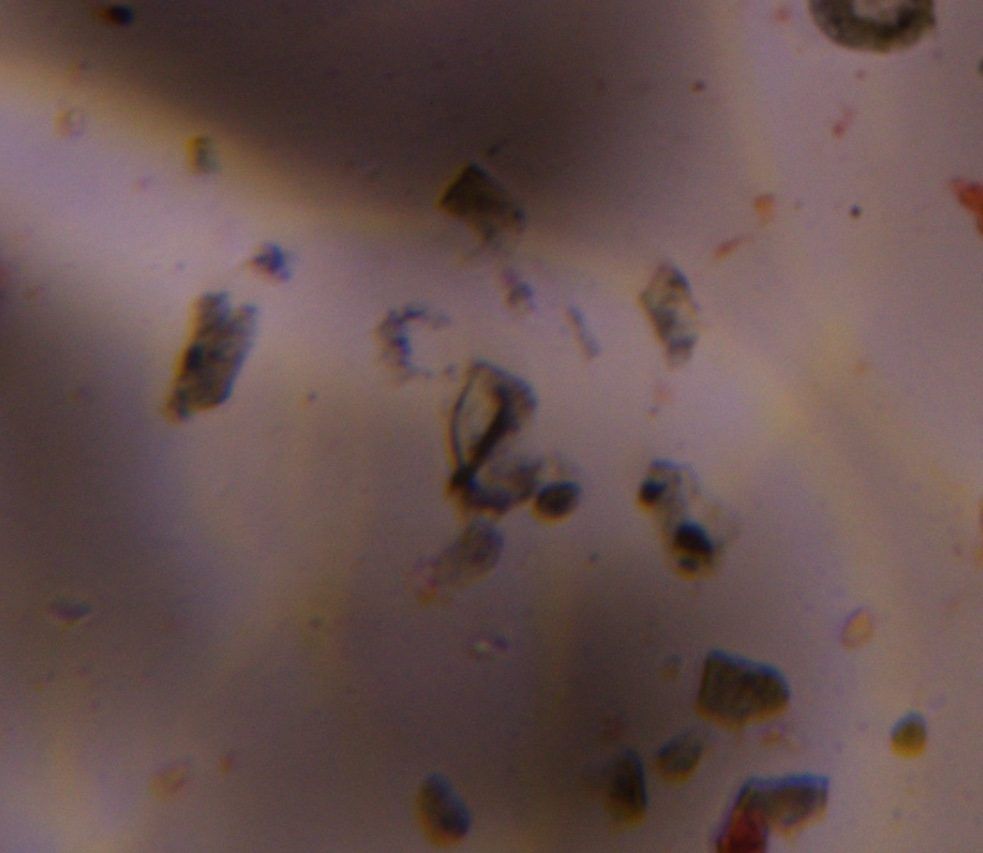 Particulate house dust under a microscope, verified by PollyMap