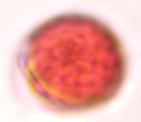 Another microscope image of Chenopod, verified by PollyMap