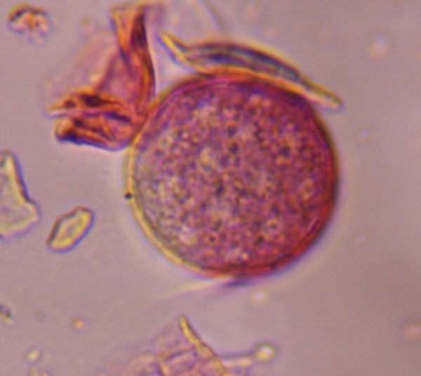 Another microscope image of Chenopod, verified by PollyMap