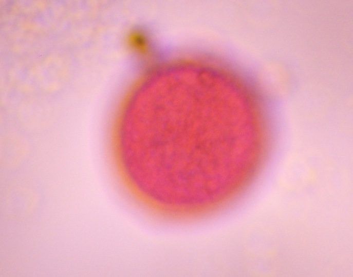 Grass pollen under a microscope, verified by PollyMap