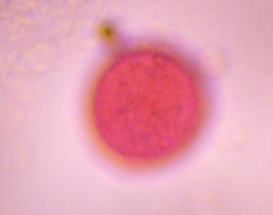 Grass pollen under a microscope, verified by PollyMap