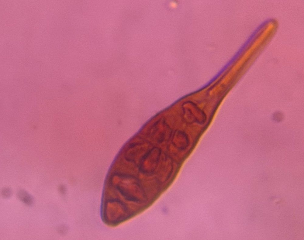 Another microscope image of Alternaria, verified by PollyMap