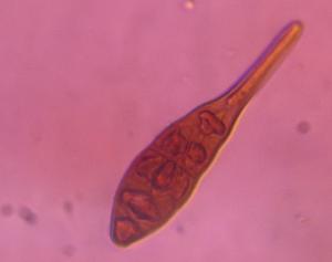 Alternaria mold spore under a microscope, verified by PollyMap