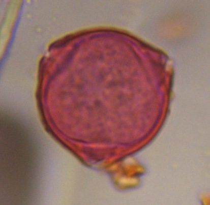unknown pollen under a microscope, verified by PollyMap