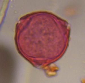 unknown pollen under a microscope, verified by PollyMap