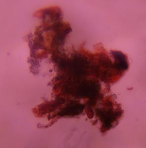 Dust house dust under a microscope, verified by PollyMap