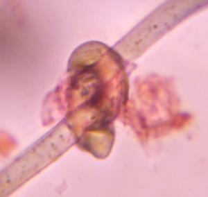 Hair particle under a microscope, verified by PollyMap