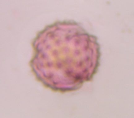 Asteraceae pollen under a microscope, verified by PollyMap