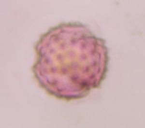 Asteraceae pollen under a microscope, verified by PollyMap