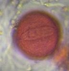 unidentified pollen under a microscope, verified by PollyMap