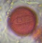 unidentified pollen under a microscope, verified by PollyMap