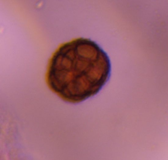 Epicoccum mold spore under a microscope, verified by PollyMap