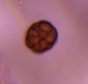 Epicoccum mold spore under a microscope, verified by PollyMap