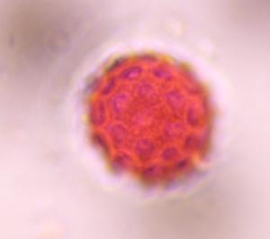 Chenopod pollen under a microscope, verified by PollyMap