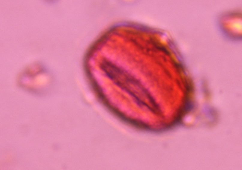 Another microscope image of Unknown, verified by PollyMap