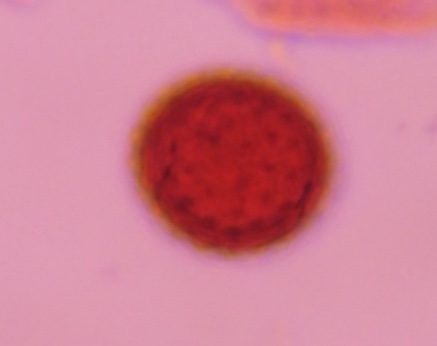 Another microscope image of Chenopod, verified by PollyMap