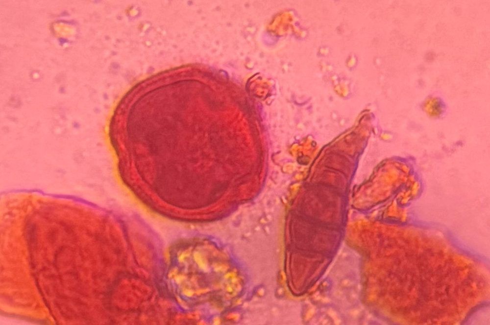 Oak pollen under a microscope, verified by PollyMap