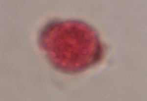 Chenopod pollen under a microscope, verified by PollyMap