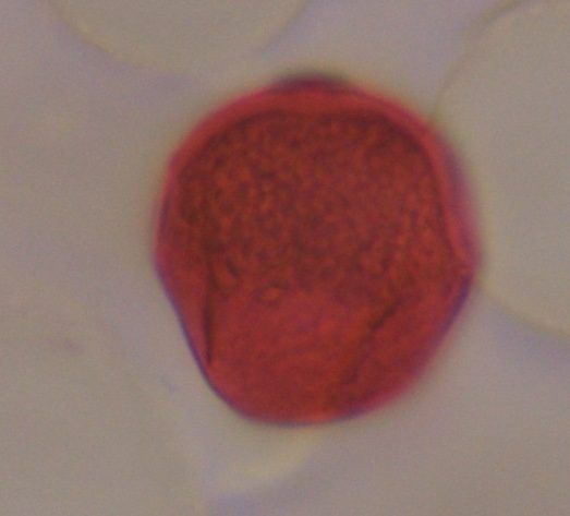 unknown pollen under a microscope, verified by PollyMap